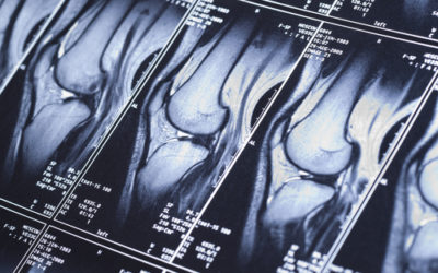 Modelling the bit in the middle: diagnostic stages of treatment